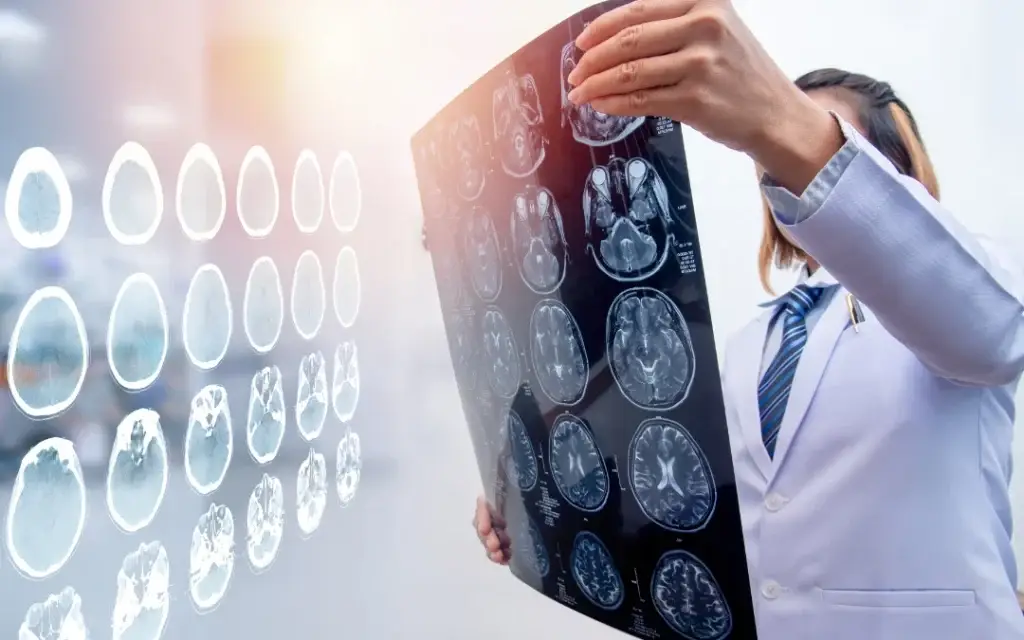 Traumatic-Brain-Injury-Caused-by-Slip-and-Fall-Accident