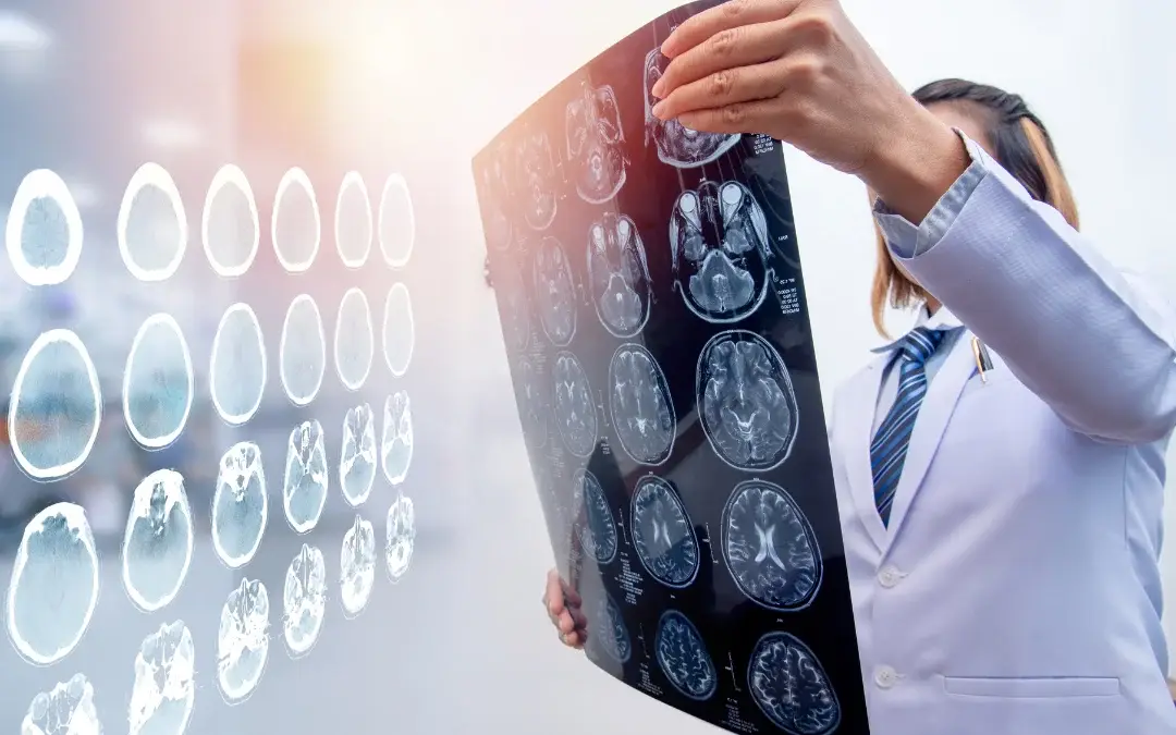 Traumatic-Brain-Injury-Caused-by-Slip-and-Fall-Accident